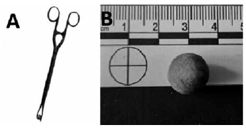 A Fórceps para retiro de balas esféricas de plomo Colección privada B Bala esférica de plomo utilizada en fusiles europeos de la primera mitad del siglo XIX Colección privada del Instituto de Estudios Históricos del Pacífico Lima Perú